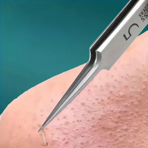 Stainless Steel Skin Care Tool Set For Blackhead And Pimples - Thumbnail Image 4