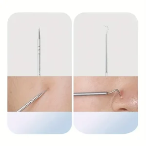 Stainless Steel Skin Care Tool Set For Blackhead And Pimples - Thumbnail Image 6