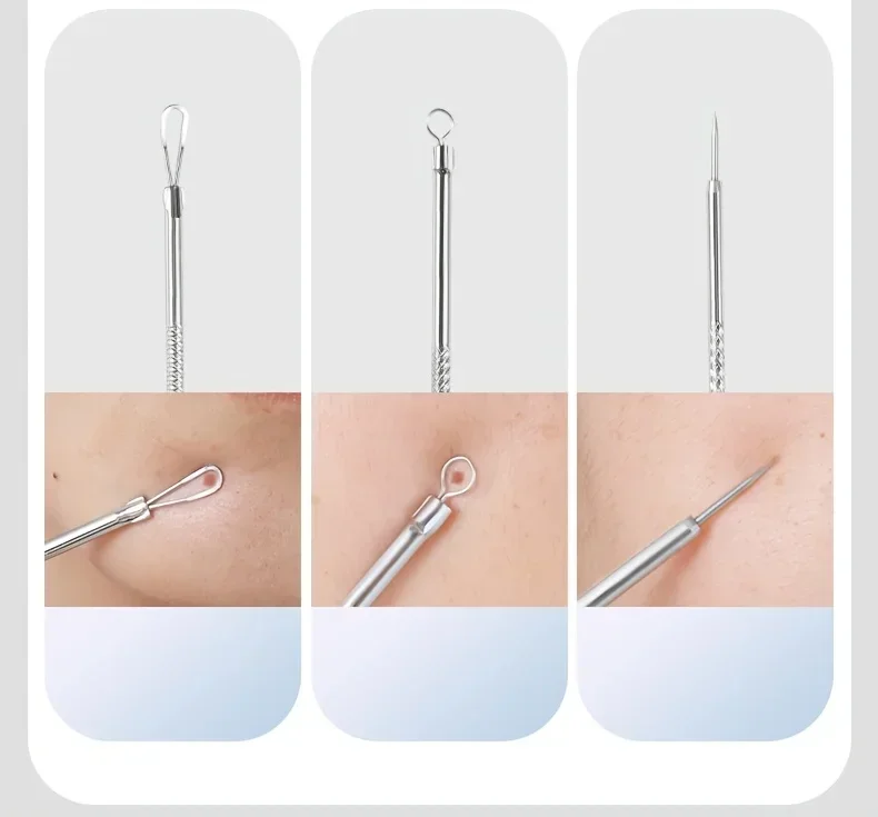 Stainless Steel Skin Care Tool Set For Blackhead And Pimples - Image 7